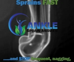 Ankle Sprain Answer